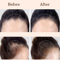 Generic Root Touch Up Hair Dye Powder β Instant Gray Coverage & Hairline Shadow for Thinning Roots, Waterproof Hair Color, Portable & Easy to Use Hair Powder, Dark Brown