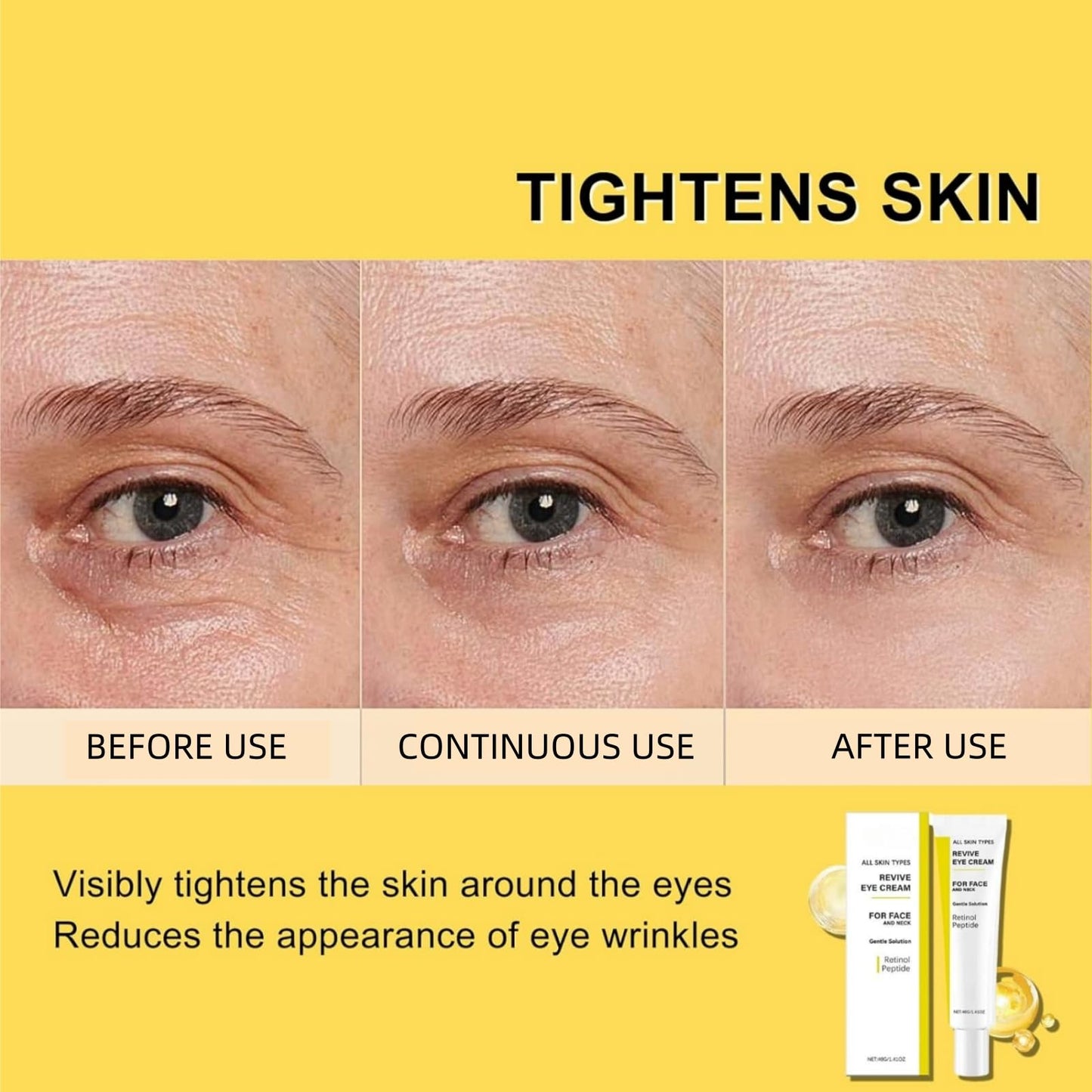 Yoowan Ret-Inol Eye Cream For Face And Neck,Ret-Inol Eye Cream,Reti-Nol Firming Serum,Reti-Nol Ey-E Serum,Anti-Aging Lotion,Under Eye Brightener,For Dark Circles And Puffy Eyes,Reduce Fine Lines