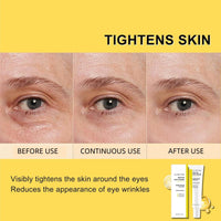 Yoowan Ret-Inol Eye Cream For Face And Neck,Ret-Inol Eye Cream,Reti-Nol Firming Serum,Reti-Nol Ey-E Serum,Anti-Aging Lotion,Under Eye Brightener,For Dark Circles And Puffy Eyes,Reduce Fine Lines