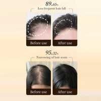 Cynamus Pack of 2 Anti Hair Loss Hair Growth Serum, Hair Serum Anti Hair Loss Hair Growth, Stimulates New Hair Growth, Promotes Thicker, Fuller and Faster Growing Hair, Thickening and Reawakening