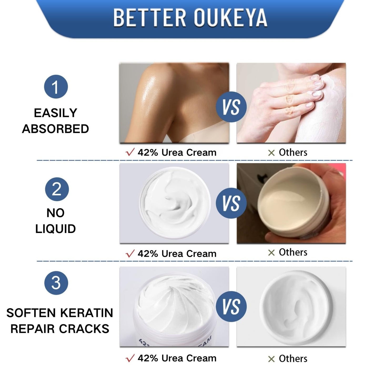Urea Foot Cream 42% - Foot Cream - Foot Cream for Cracked Heels and Dry Skin - Cracked Heel Repair Cream for Hand and Feet - 42% Urea Cream & 2% Salicylic Acid for Callus Remover & Nourishes Soften