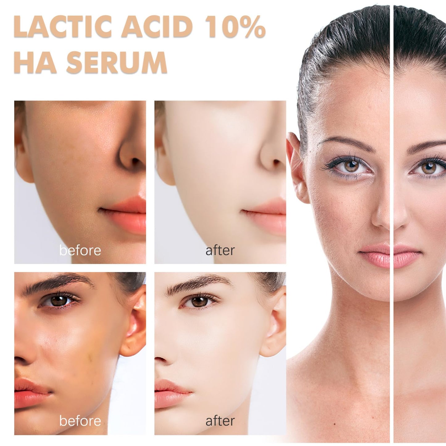 MrCuvaryas 10% Lactic Acid Serum With Hyaluronic Acid Serum For Face, 3 In 1 Combine Vitamin C Serum For Face, Face Serum For Shrink Pores, Hydrated, Even Skin Tone, Antioxidation, Oil Control