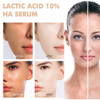 MrCuvaryas 10% Lactic Acid Serum With Hyaluronic Acid Serum For Face, 3 In 1 Combine Vitamin C Serum For Face, Face Serum For Shrink Pores, Hydrated, Even Skin Tone, Antioxidation, Oil Control
