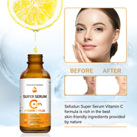 NatrLuxe Vitamin C & Turmeric Face Serum For Aging & Wrinkles - Oil With 20% Vitamin C, Improves Dark Spots & Fine Lines, Moisturizing Skin Care Formula