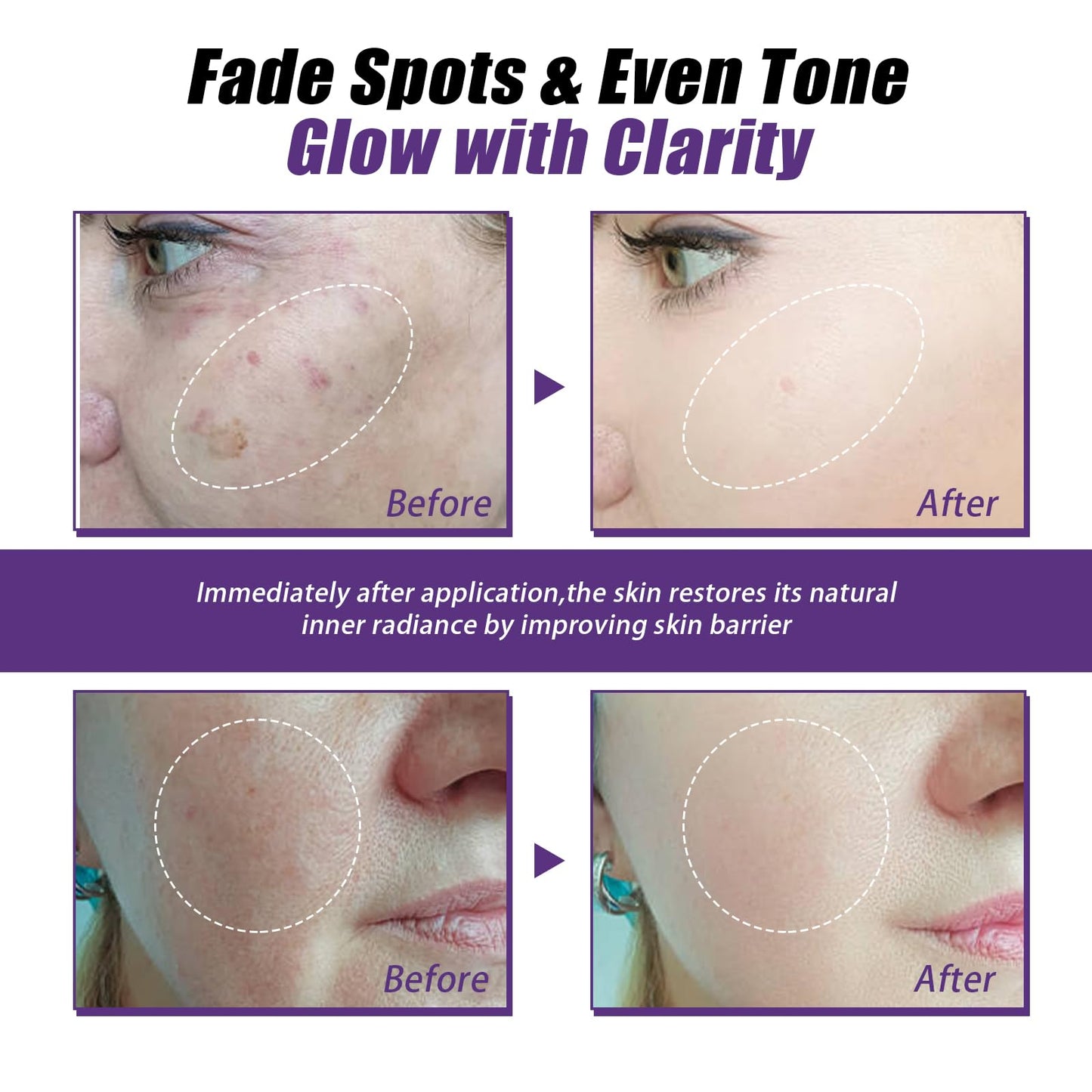 Katslyn Skin Tightening Cream for Face