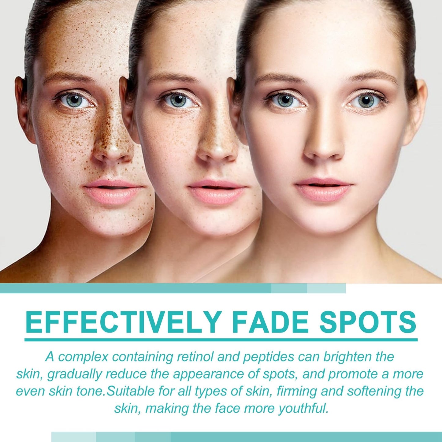 White Spot Cream,Herbal Freckle-Removing Cream,Lightening Cream for Face,Dark Spot Remover for Face,Dark Spot Corrector,Spot Cream,Freckle Removal Cream,Age Spot Remover for Face,Dark Spot Serum