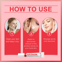 MINSHZEE Freckle Removal Cream - Removes facial dark spots, Dark Spot Remover with Niacinamide and Vitamin C, Improves dull skin (1 piece)