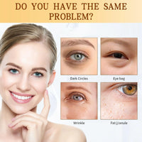 OuXing Caffeine Eye Serum,Under Eye Cream for Dark Circles and Puffy Eyes,Day & Night Eye Cream Anti Aging,Eye Serum with Massage Ball,Dark Circles Under Eye Treatment Women,Firming Ey/e Cre/am