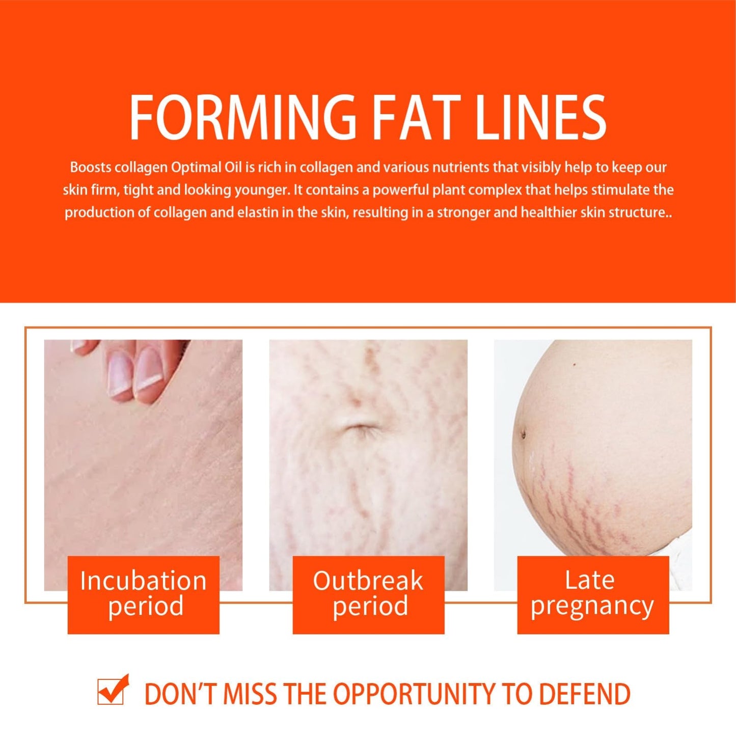 Stretch Mark Treatment Oil for Women - Optimal Formula for Removal of Stretch Marks, Scars, Firming & Lifting Body Care, 50ml