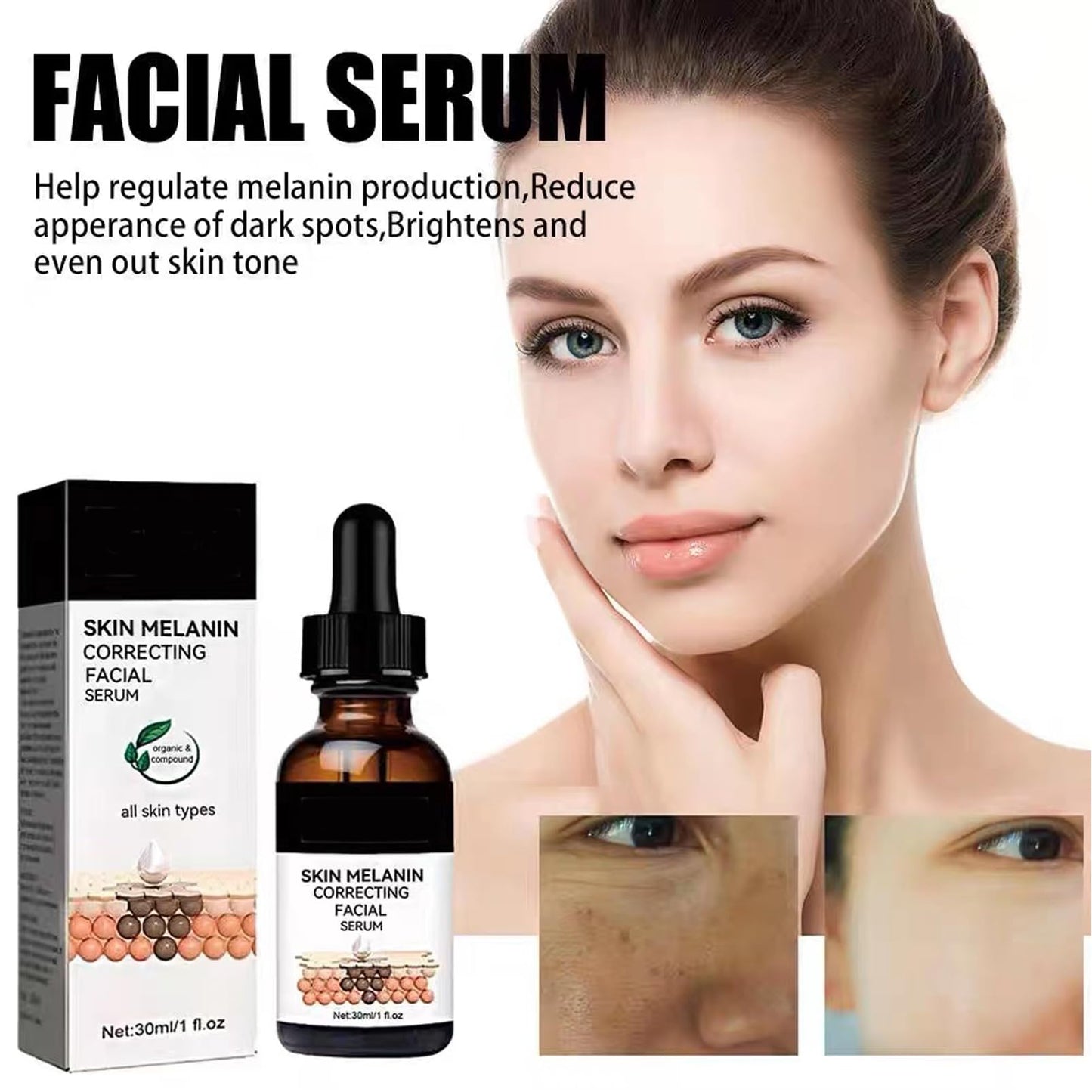 Dark Spots Correcting Facial Serum,2PCS Brightening Facial Serum,Rapid Dark Spot Correcting Serum,Improve Dry Skin & Smooth Skin,Brightening Serum,Dark Spot Remover Serum For Melanin Correcting