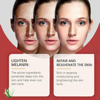 Kojic Acid Cream,Dark Spot Remover for Face,Skin Lightening Cream for Anti Aging,Dark Spot Correcting Glow Serum,Face Moisturizer for Women,Pigmentation Removal Cream,Freckle Removal Cream,Dark Spots