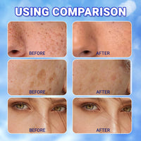 GMHLLES 2 Bottles Urea Cream 60 Percent for Feet,70g Cracked Heel Repair Cream,Urea Moisturiser,Lightweight and Gentle,Suitable for Cracked Feet and Dry Body Skin Care,with 1 Massage Board