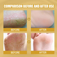 Honey Foot Cream,Hand & Foot Cream for Very Dry Feet & Hands,Cracked Heel Repair Cream,Foot Mask,Foot Moisturiser,Hard Skin Remover,He/el Balm for Cracked H/eel,Feet Cream,F/oot Balm
