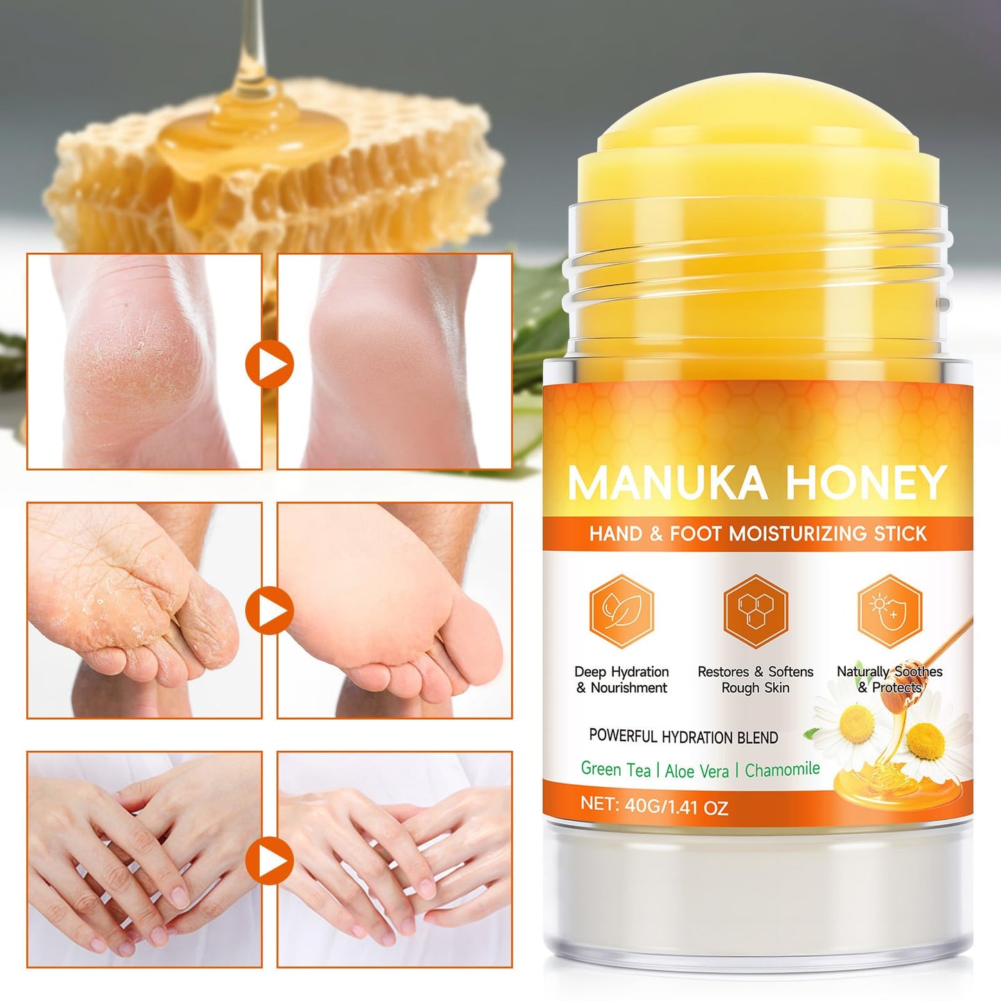 ThamGlow 2Pcs Manuka Honey Cream For Dry Feet, Cracked Heel Repair Cream, Honey Foot Balm, Softens Calluses, Exfoliates Dead Skin & Deeply Moisturises – Athletes Foot Treatment Heel Balm For Hard, Rough Skin