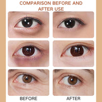 ISBEAUSOLS Caffeine Solution 5%+EGCG Eye Serum - Caffeine Eye Serum - Caffeine Eye Cream Anti Aging - Eye Cream for Dark Circles and Puffy eyes - Eye Bags Remover - under Eye Brightener 30ml