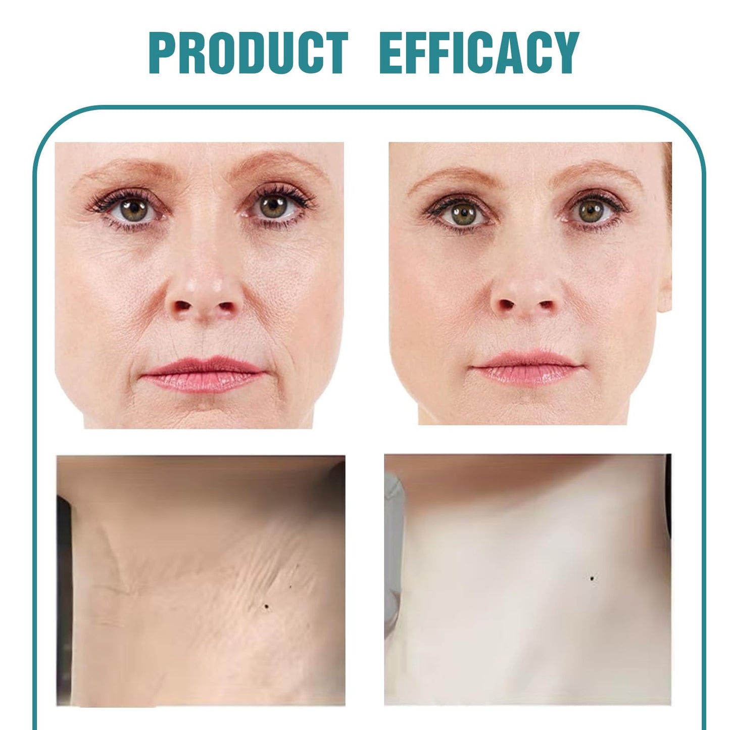 FunnAura Crepe Be Gone Body Souffle, Neck Firming Cream, Skin Tighten and Lift Neck Cream for Anti Wrinkle and Hydration