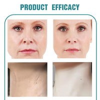 FunnAura Crepe Be Gone Body Souffle, Neck Firming Cream, Skin Tighten and Lift Neck Cream for Anti Wrinkle and Hydration