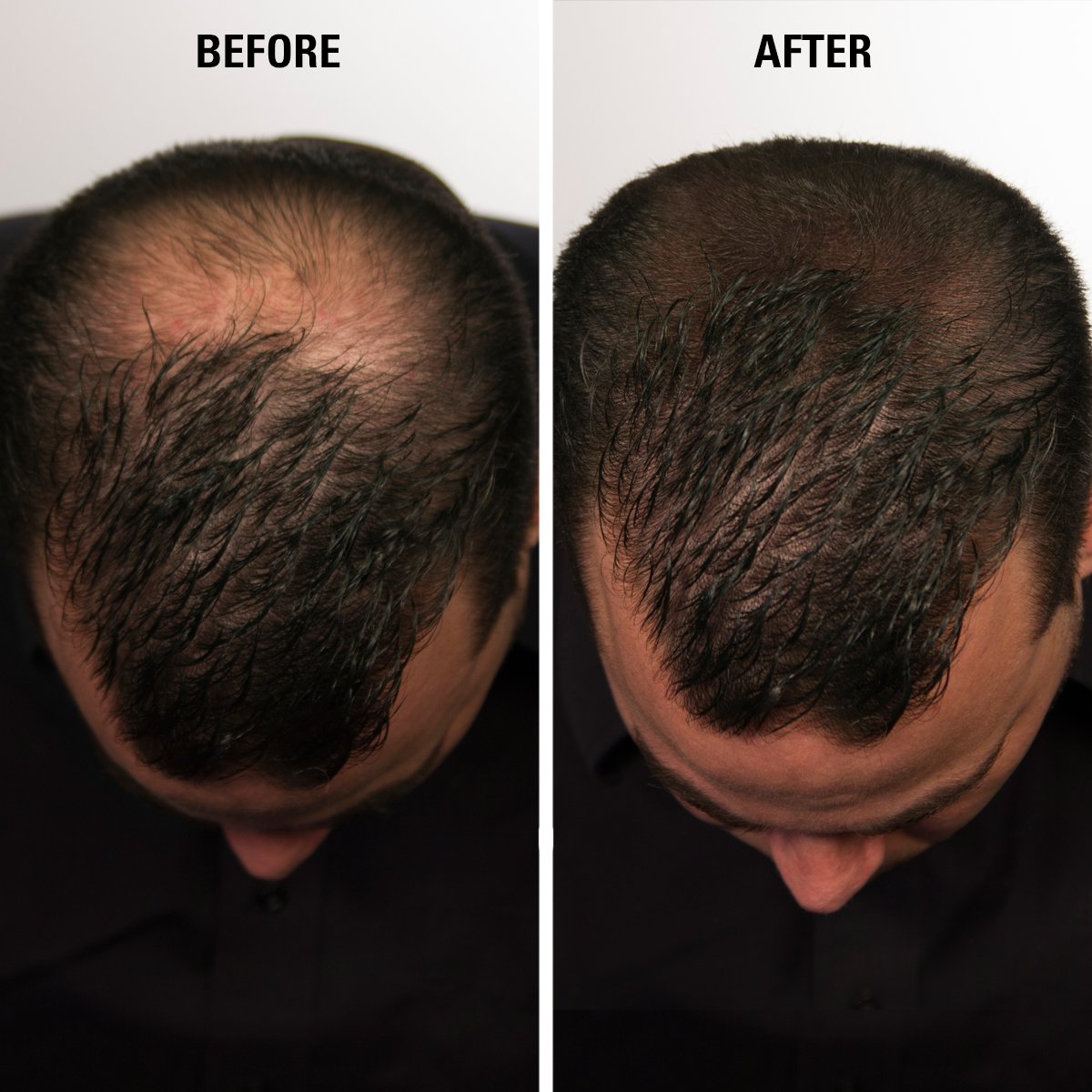Infinity Hair Building Fibers To Conceal Thinning For The Appearance Of Thicker, Fuller Women & Men - Auburn 28G
