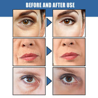 Jinjiar Retinol Collagen Cream with 5% Hyaluronic Acid,Retinol Face Cream with Collagen,Anti Wrinkle Face Cream,Anti Aging Face Cream,Retinol Serum for Face,Night Moisturiser,Day Cream for Women Anti Aging