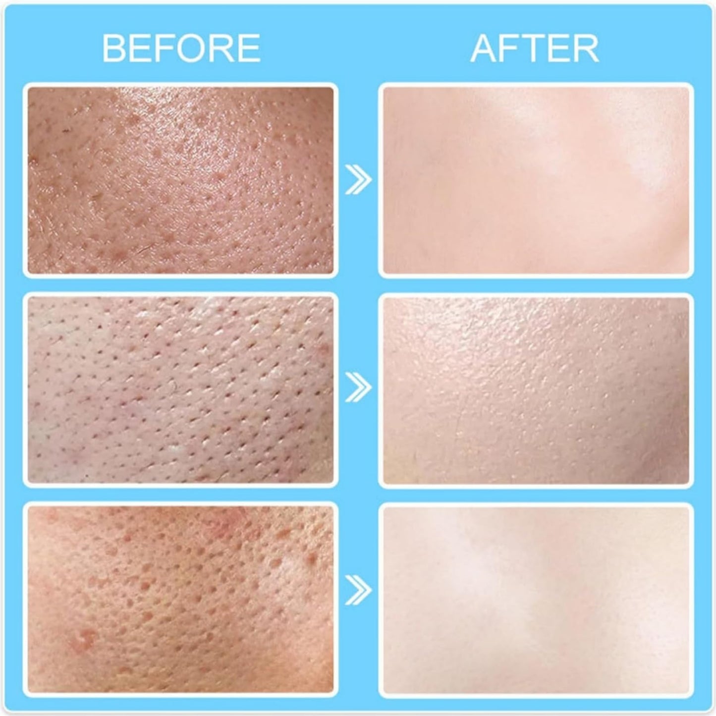 Heefeng Pore Shrinking Invisibility Filler Primer,Pore Minimizer Primer,Pores Reducer For Face,With Hyaluronic Acid,Smooths Conceals,Blurring Poreless Face Primers,Oil-Control,For All-Day Wear Makeup,50g