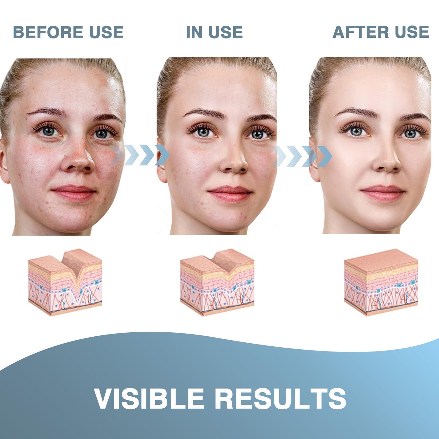 DOOCECIY 2 PCS Pimple Cream, Nourishing Acne Balm for All Skin Types