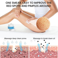Strawberry Legs Treatment Body Cream,Keratosis Pilaris Cream Treatment with Vitamin E and Urea,Skin Exfoliating Repair Cream for Chicken Skin Treatment,Eliminates Strawberry Spots(30G)