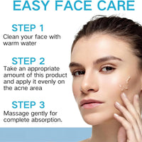 2PCS Acne Treatment Gel,Acne Cream Useful,Anti Acne Face Cream,Anti Acne Removal Cream,Acne Spot Treatment Cream,Pimple Treatment Gel Cream,Face Ance Gel,Acne Treatment Spot and Blackheads Treatment