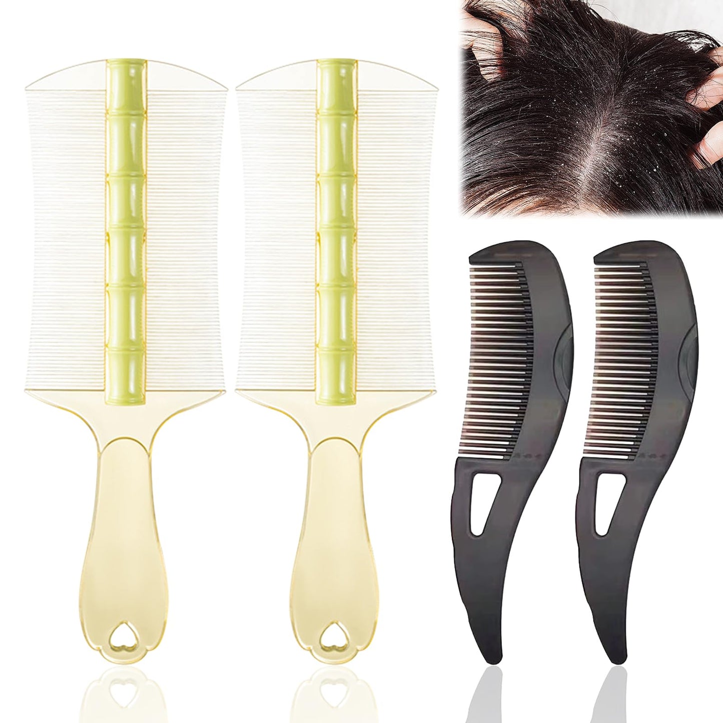 4 PCS Dandruff Comb Scalp Comb Psoriasis Comb 2 Hollow Tooth Comb with 2 Scalp Brush for Fine Hair and for Thick Hair for Removing Fleas Lice Dandruff and Tangled Hair
