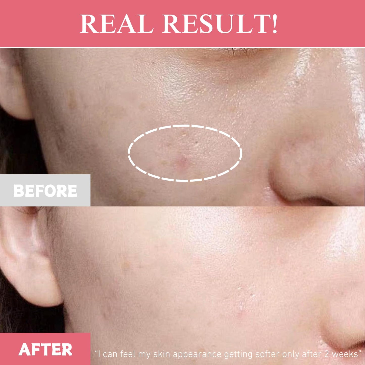 TXA Niacinamide Capsule Cream, Dual Radiance Moisturizer, Korean Face Moisturizer & Dark Spot Corrector with Tranexamic Acid, Niacinamide Capsules for Glass Skin, Lightweight Hydrating Korean Skincare
