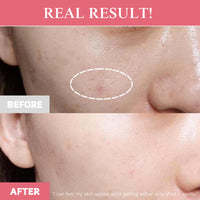 TXA Niacinamide Capsule Cream, Dual Radiance Moisturizer, Korean Face Moisturizer & Dark Spot Corrector with Tranexamic Acid, Niacinamide Capsules for Glass Skin, Lightweight Hydrating Korean Skincare