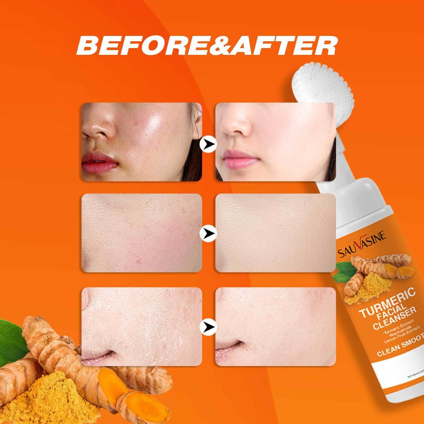 IZBEAUVO urmeric Face Wash, Turmeric Foaming Cleanser,Turmeric Facial Cleanser, Ultra-Gentle Clean And Clear Cleanser For Acne Prone Skin