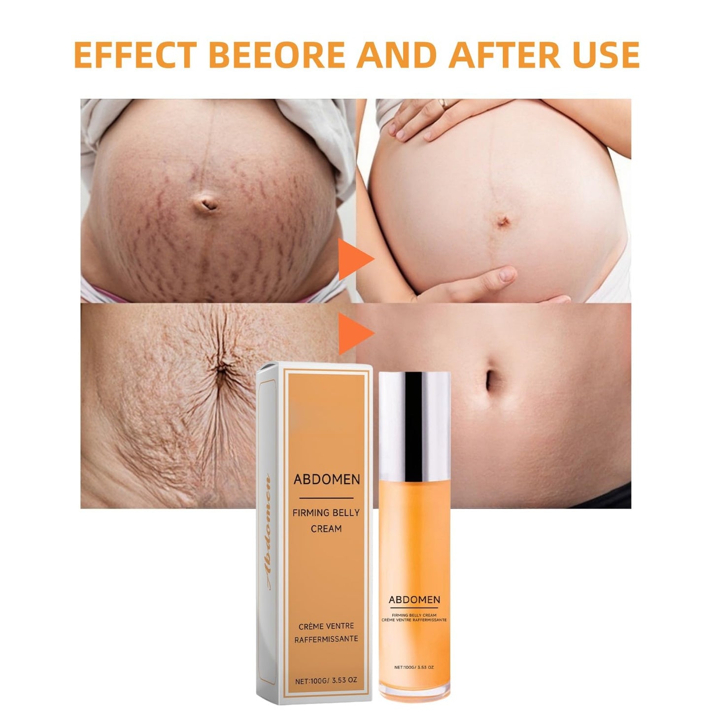100g Belly Firming Cream,Skin Tightening Firming Body Cream,Skin Fi/rming Cre/am,Sk/in Tightening Body C/ream,B/ody Fir/ming Cre/am,Sk/in Tighte/ning Moisturizing,S/kin Smoothing Crea/m,Ski/n Cre/am