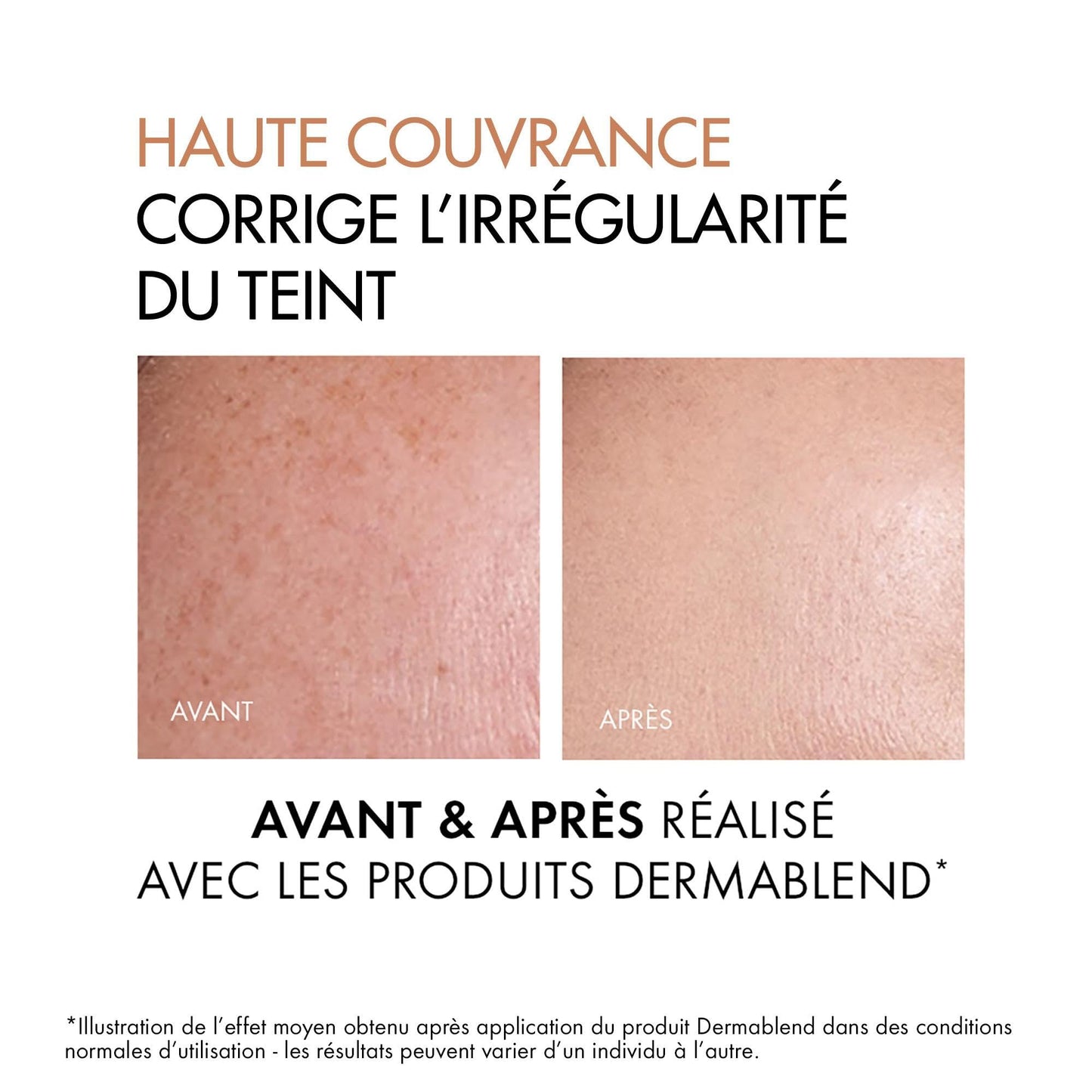 Dermablend Fond De Teint Correcteur Spf35 25-Nude 30 Ml