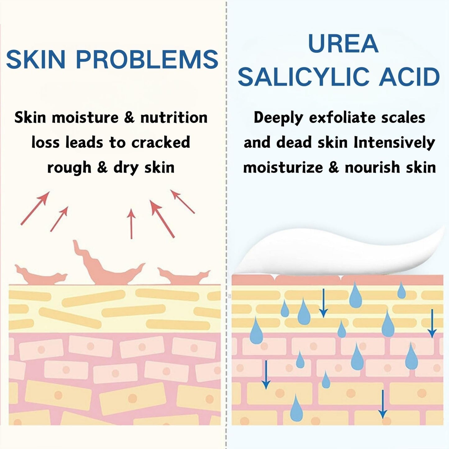 60% Urea Cream - Cracked Heel Repair Cream - Urea Foot Cream with Salicylic Acid, Aloe Vera- Foot Cream for Cracked Heels and Dry Skin - Skin Care for Foot Moisturiser (3PCS)