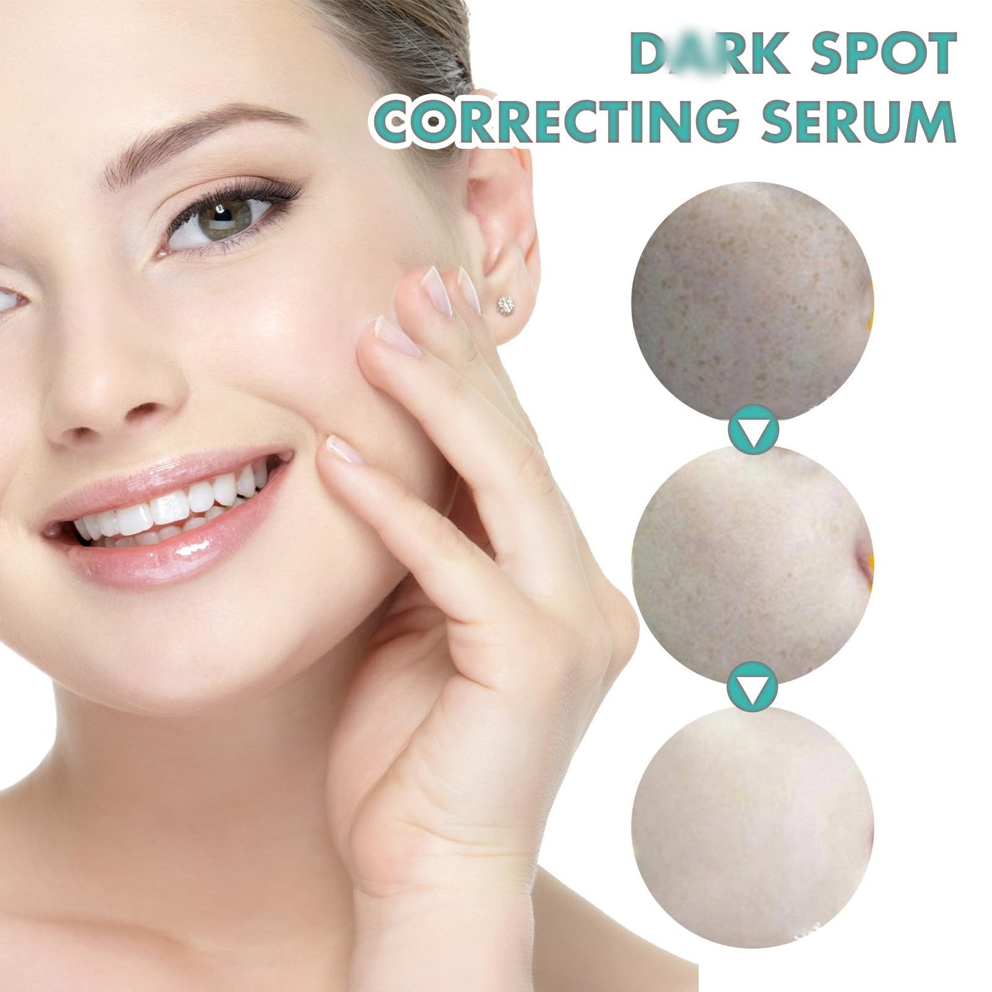White Spot Cream,Herbal Freckle-Removing Cream,Lightening Cream for Face,Dark Spot Remover for Face,Dark Spot Corrector,Spot Cream,Freckle Removal Cream,Age Spot Remover for Face,Dark Spot Serum
