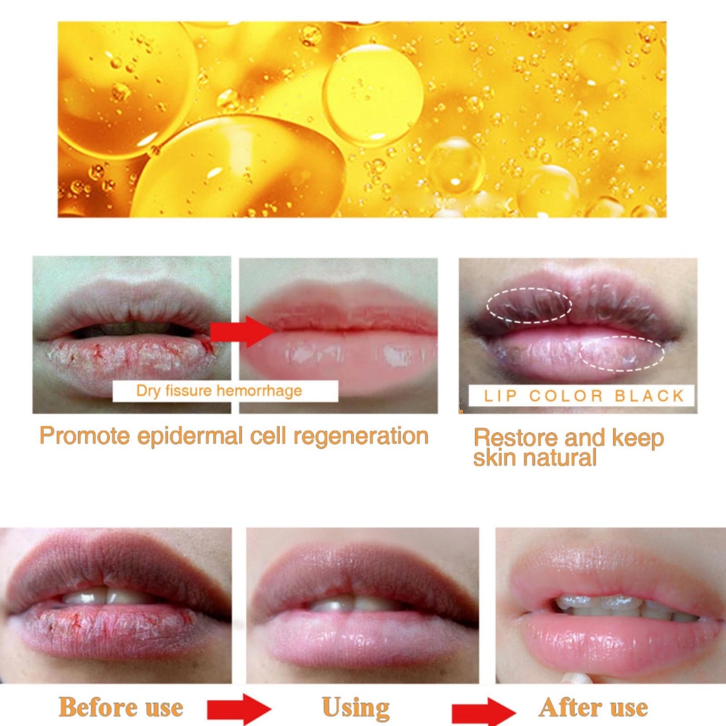 Ginger Lip Lightening for Dark Lips,Lips Pink Bleaching Cream Balm,Lip Balm,Fast Moisturizing Lightening Lip Balm,Brightening Cream Blam,Lip Care Lightens Remove Dark Lips,Lip Pigmentation Treatment