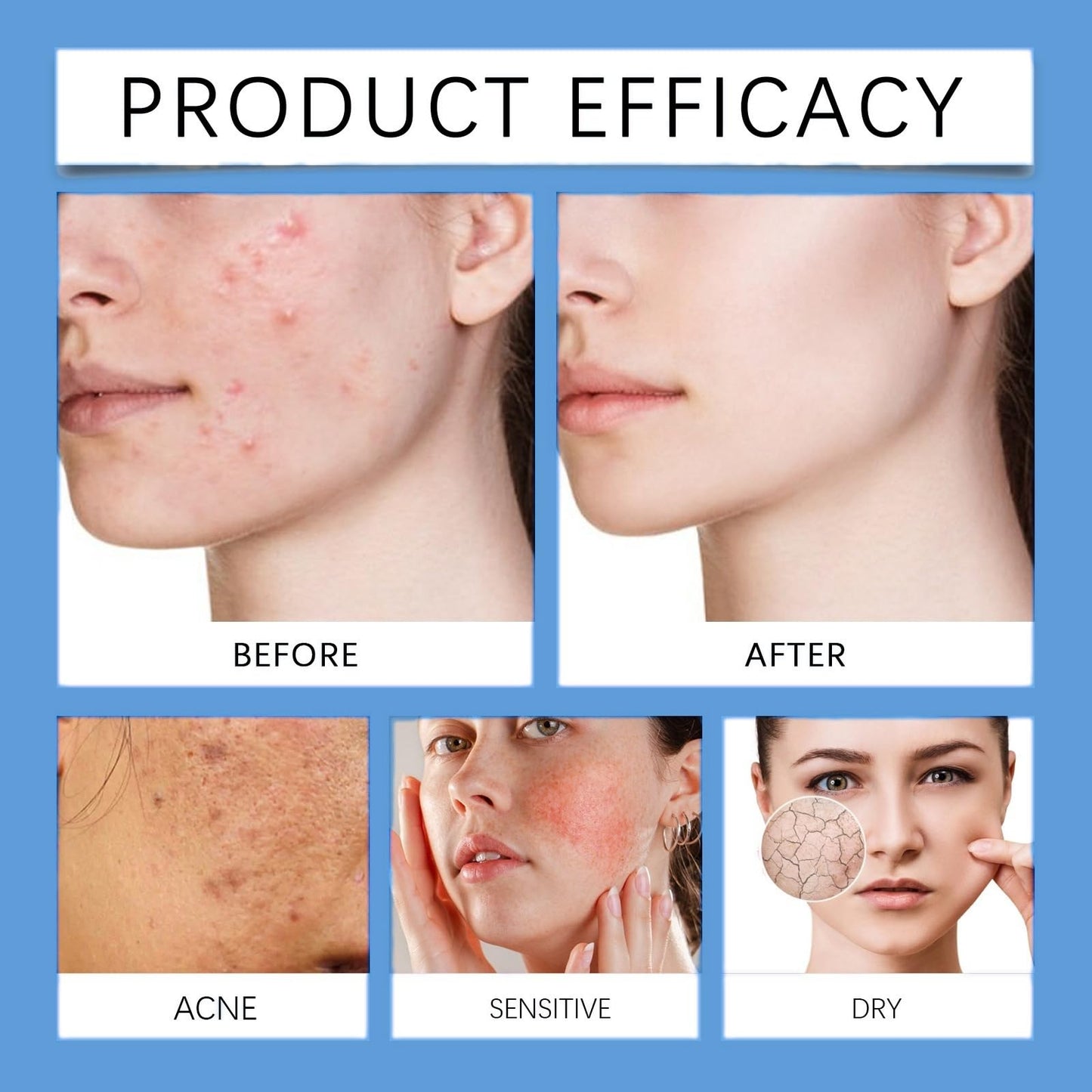 Dark Spot Cream,Anti Aging Face Cream for Freckles&Hyperpigm/entation,Spot Treatment,Skin Tightening Cream for Face,Skin Whitening Cream,Trane/xamic Acid&Niacinamide Facial Moisturizer,Gentle Formula
