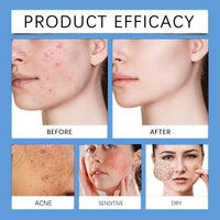 Dark Spot Cream,Anti Aging Face Cream for Freckles&Hyperpigm/entation,Spot Treatment,Skin Tightening Cream for Face,Skin Whitening Cream,Trane/xamic Acid&Niacinamide Facial Moisturizer,Gentle Formula