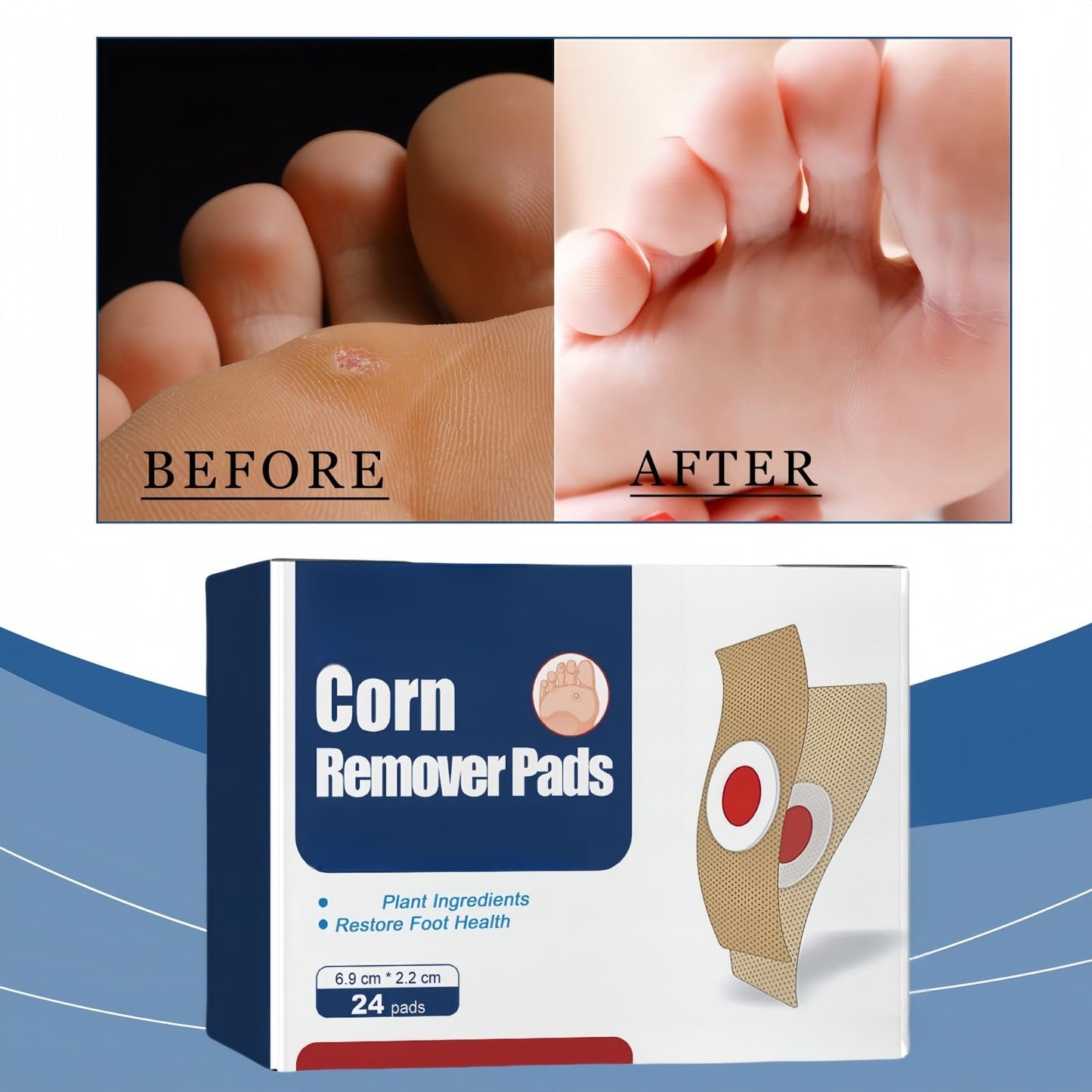 Xunzhi 24pcs Wart Treatment Patch,Corn Remover Pads,Verruca Treatment Corn Plasters,Foot C/ORN Remover Patch C/ORN,Wart R/emover,Co/rn Callus R/emover,Pain Relief W/Art Plaster,Co/rn Plasters for Toes