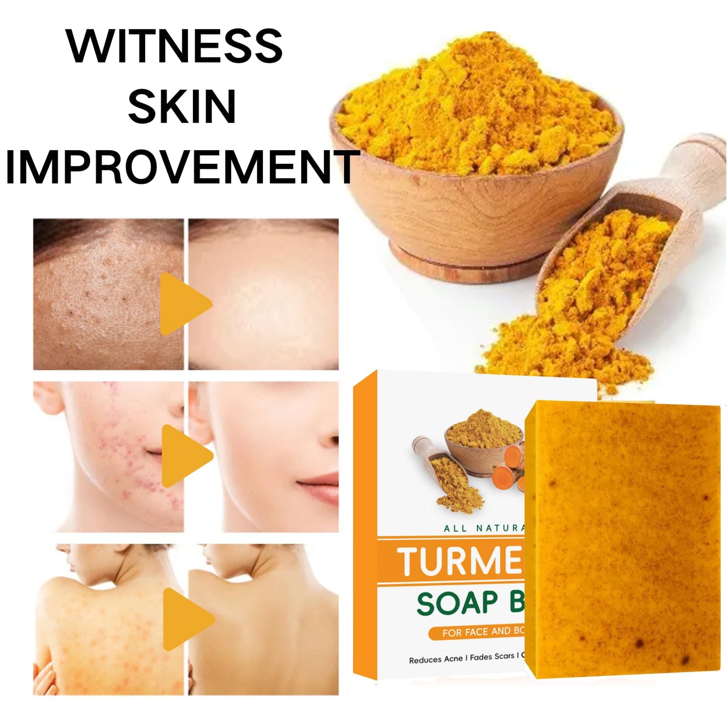 Turmeric Soap Bar - Kojic Acid Soap - Tumeric Soap for Cleansing - Dark Spot Corrector Remover - Natural Soap for Acne, Dark Spots, Hyperpigmentation, Smooth Skin(2pcs)