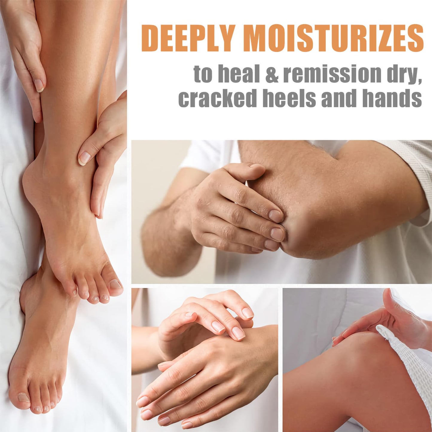 CTUBLIAUNX Cracked Heel Repair Cream with Manuka Honey – Foot Cream for Cracked Heels & Dry Skin, Fast-Absorbing Moisturizer for Rough, Peeling Feet
