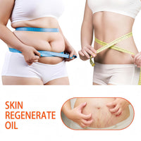 125ml Stretch Mark Oil & Scar Treatment, Skin Regeneration Oil for Stretch Marks Removal, Firming & Lifting, Collagen Boost - Body Oil for Women