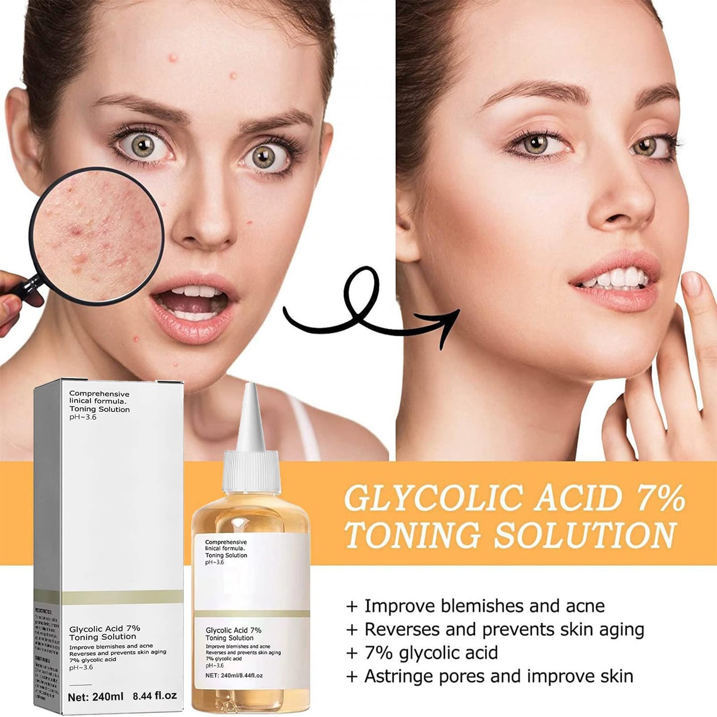 Glycolic Acid 7% Toning Solution, Hydrating Toner for Face,Glycolic Acid Skin Toner Smoothing Face Toner Facial Exfoliation for Blemishes and Acne Facial Moisturizer-Repair Damage Skin (240ml)