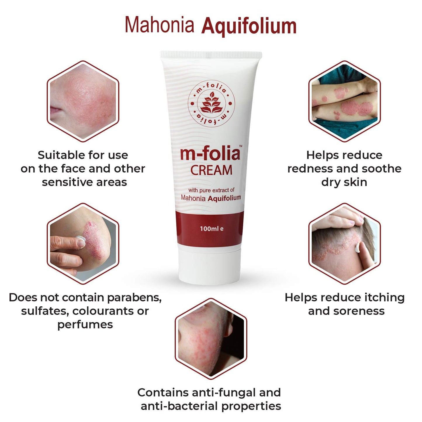 M-Folia M-FOLIA Psoriasis Cream. A Rich, Non-Greasy Skin Cream Specially formulated for Treating Psoriasis, Eczema & Related Dry Skin Conditions