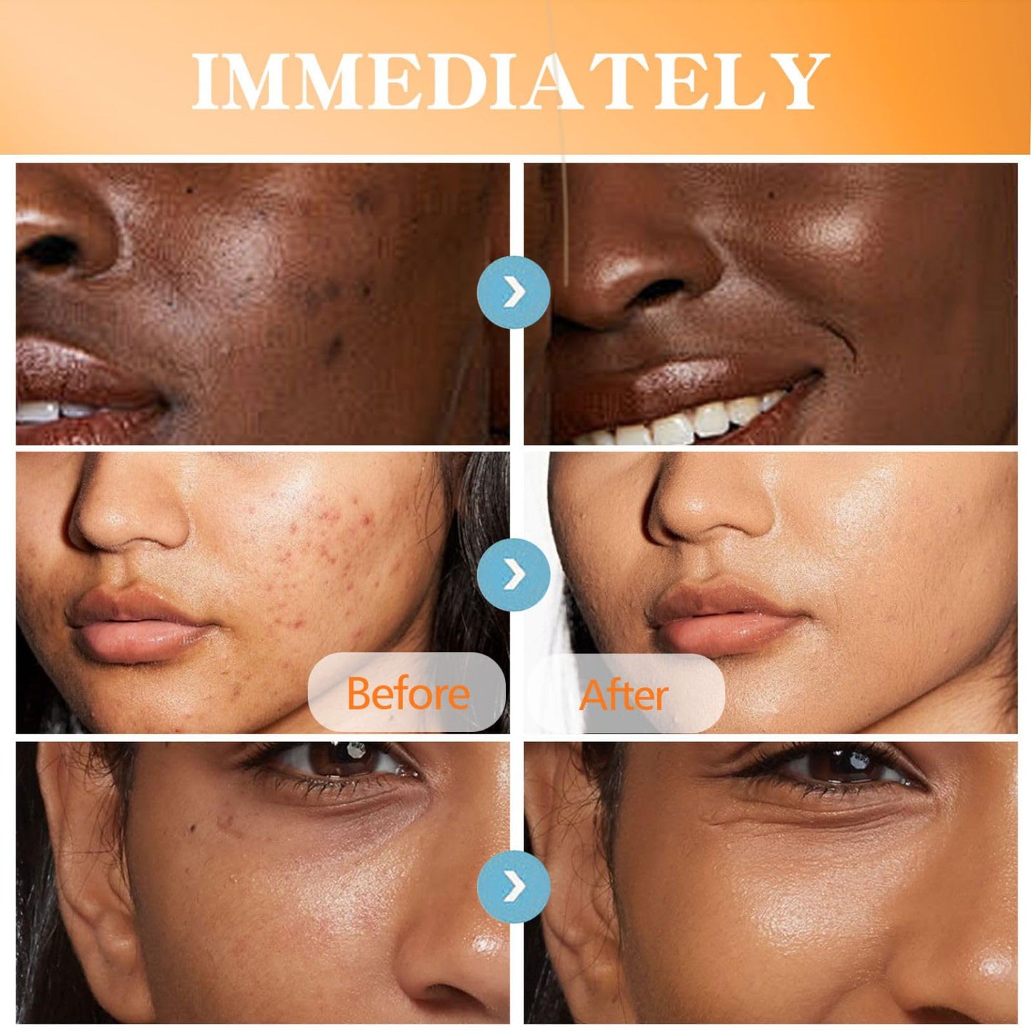 Turmeric Body Lotion, Tumeric Cream For Face And Body,Remove Acne,Dark Spots,Sun Damaged Skin,Anti-Aging Firming Body Lotion Body & Face Dry Skin Moisturizer Women Men
