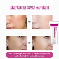 Arbutin 7% + Tranexamic Acid 4% Cream, Dark Spot Corrector Face Cream with Niacinamide & Hyaluronic Acid, Gentle Skin Brightening Korean Moisturiser, Targets Hyperpigmentation, Melasma,Even Skin Tone