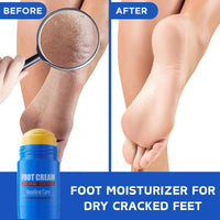 Shefave 2PCS Vaseline Foot Cream Stick, Foot Repair Cream for Cracked Heels and Dry Skin, Vaseline Intensive Care Deep Moisturiser Stick, Foot Balm for Calluses and Severe Dry Feet,Softens Exfoliates,Portable
