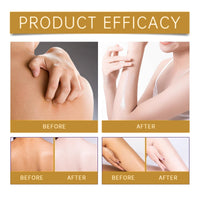 Bee Ve-nom Cream,Bee V-enom Treatment Cream,Professional Bee V-enom Repair Cream,Natural Moisturizing Cream for All Parts of The Body,Soothing Bee V-enom Removal Cream,Fast-Acting Bee Ve-nom Cream