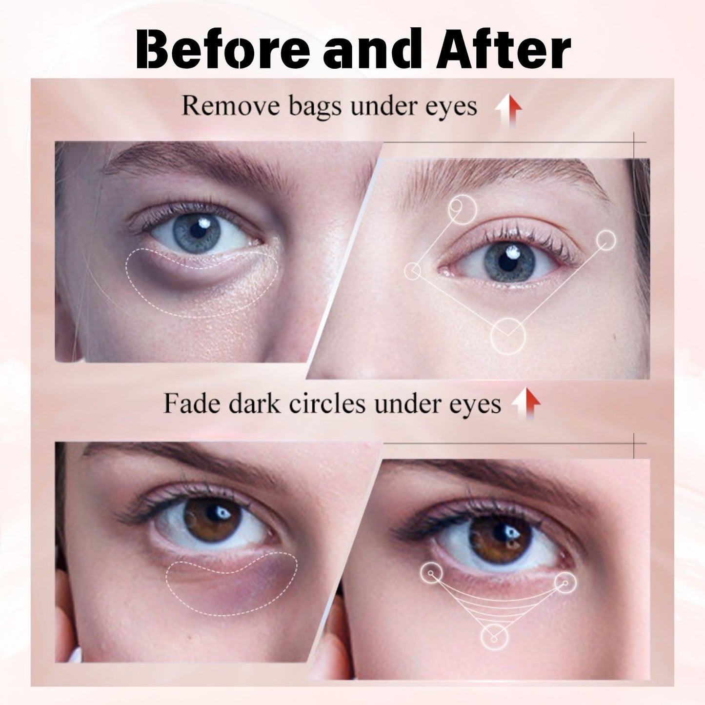 Anti Aging Face Cream & Eye Cream Set with Kojic Acid – Dark Spot Remover for Face & Dark Circle Cream – Brightening Product & Anti Wrinkle EyeCream for Women, Day & Night Moisturiser, 30g+20g