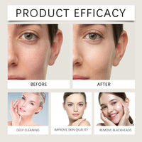 Relief Mud Mask,Recovery & Relief Mud Mas/k,Rel/ief Moisturizes Face Ma/sk,Recovery Mud M/ask,Body Mud Hydrating & Moisturizing,Skincare for Deep Cleansing,Deep Po/re Cleanse,Hydrating Face & Body